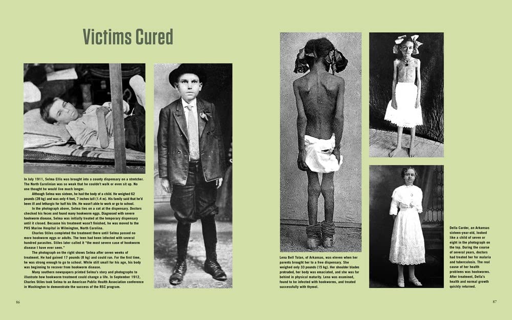 American Murderer: The Parasite that Haunted the South (Medical Fiascoes)