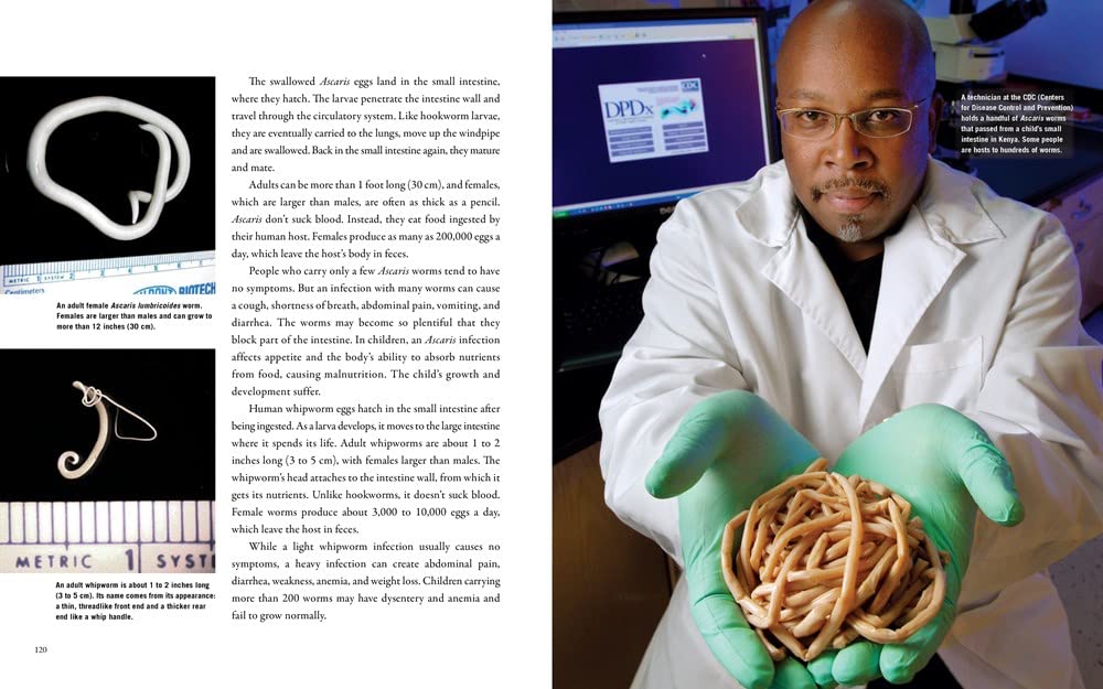 American Murderer: The Parasite that Haunted the South (Medical Fiascoes)